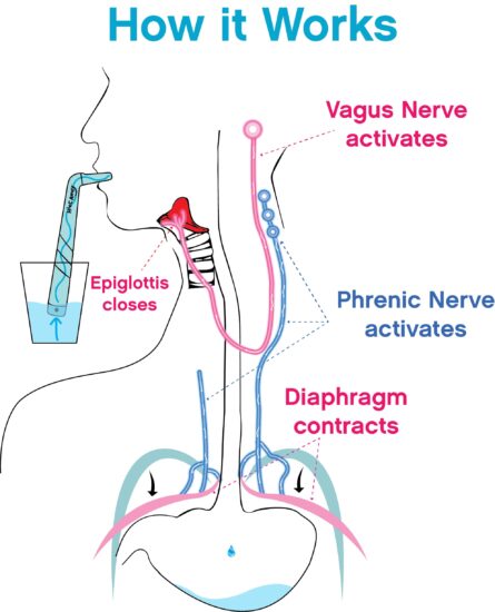 HiccAway Hiccup Straw - Stops Hiccups Naturally & Fast - As Seen On Shark Tank - Clinically Proven Relief for All Ages, Children & Adults - Safe, Lightweight, & Reusable product image
